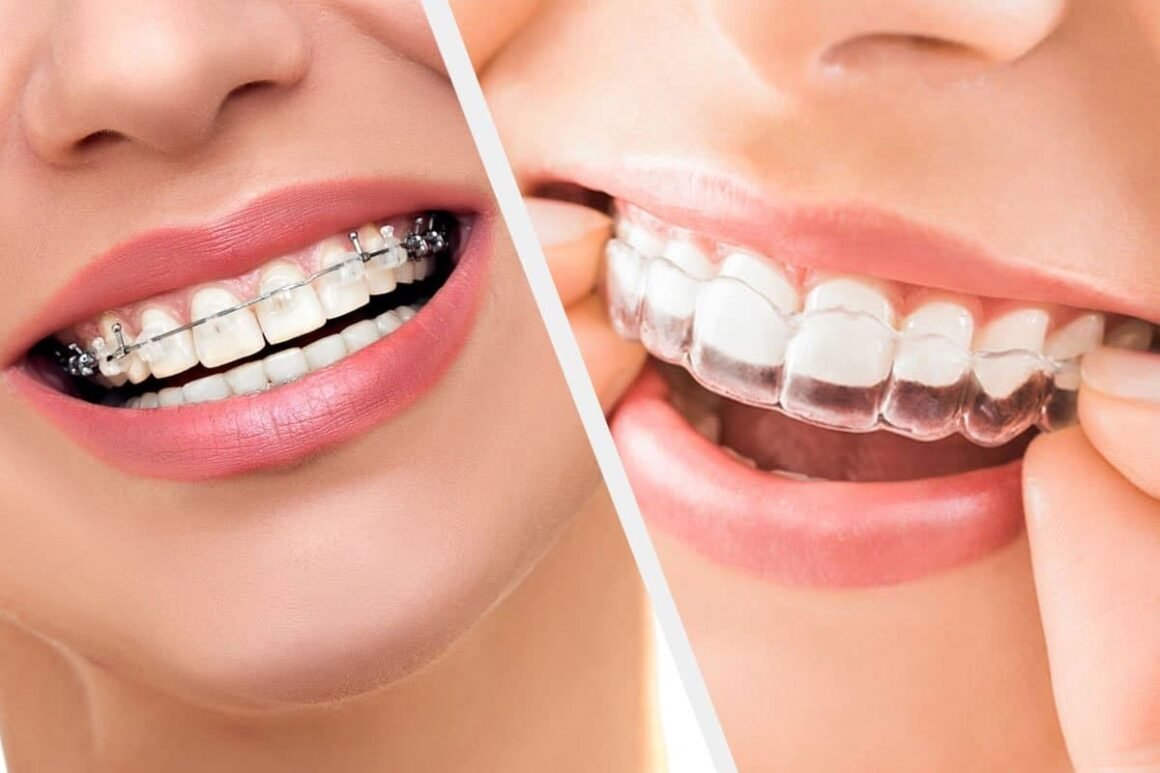 5 Safe and Effective Methods to Brighten Your Teeth dental